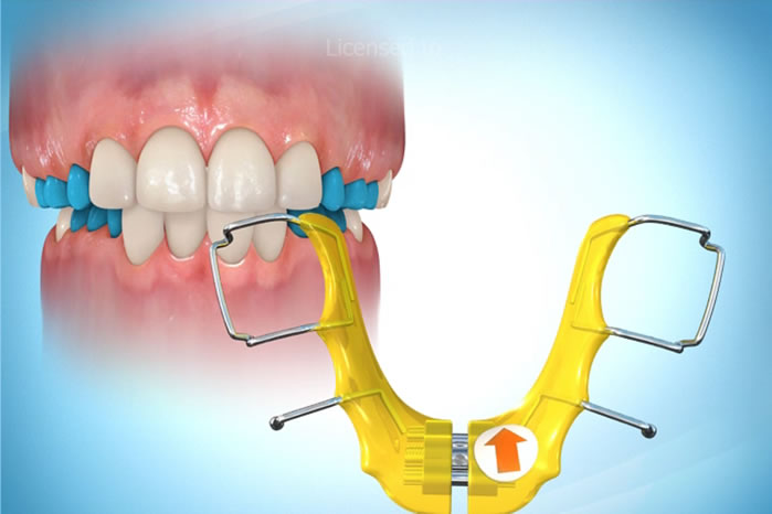 tratamento-ortodontico-para-criancas